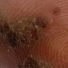 Vibha skin