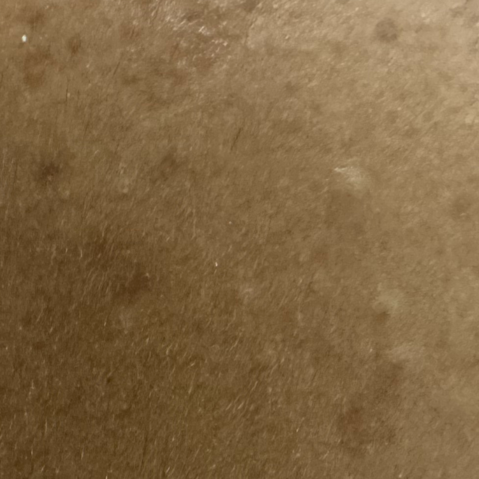 Vibha skin