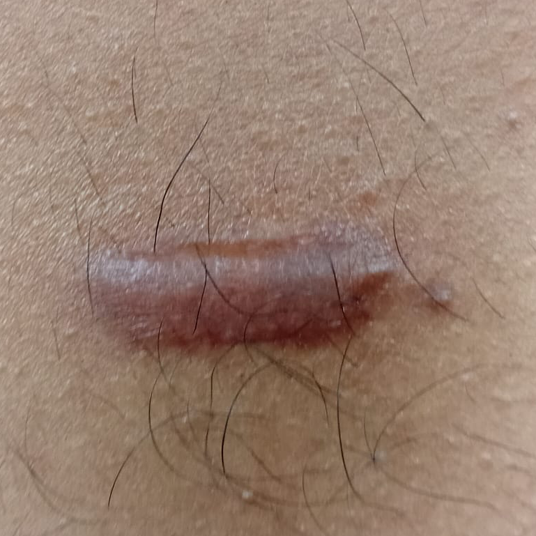 Vibha skin