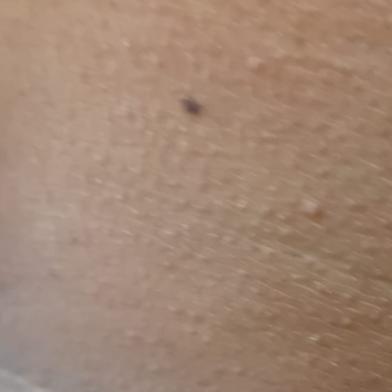Vibha skin