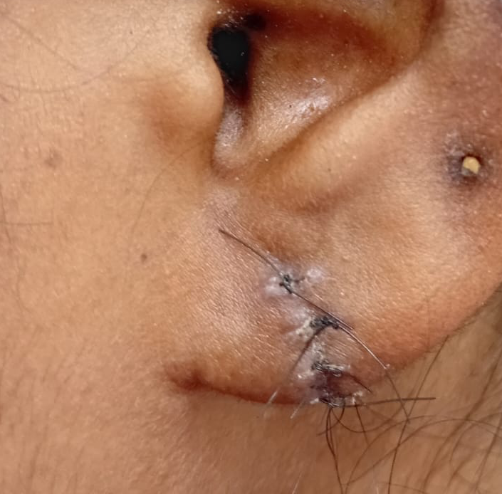 Vibha skin