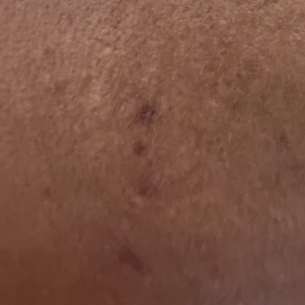 Vibha skin