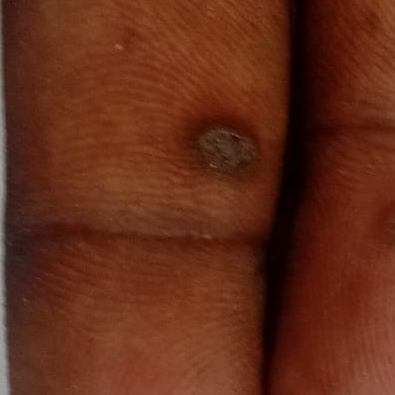 Vibha skin