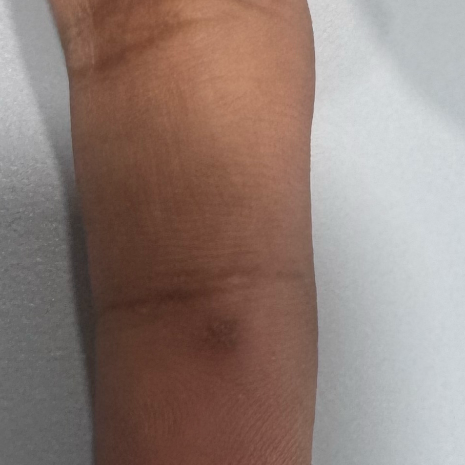 Vibha skin