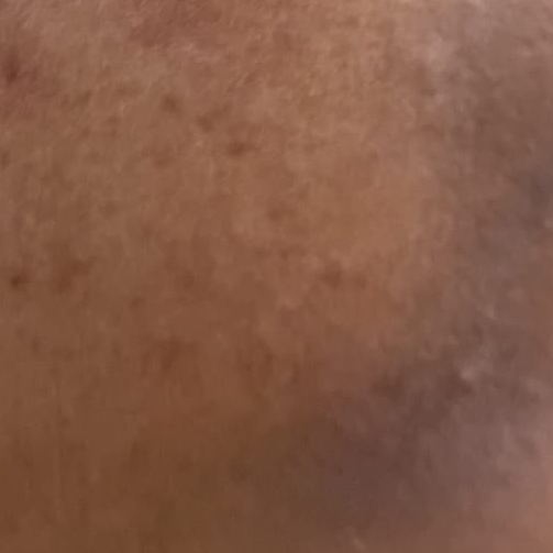 Vibha skin