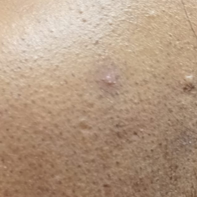 Vibha skin