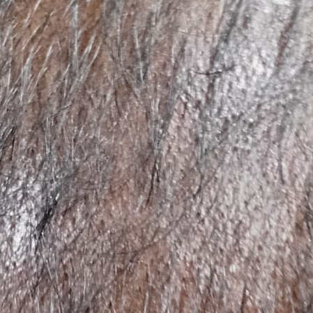 Vibha skin