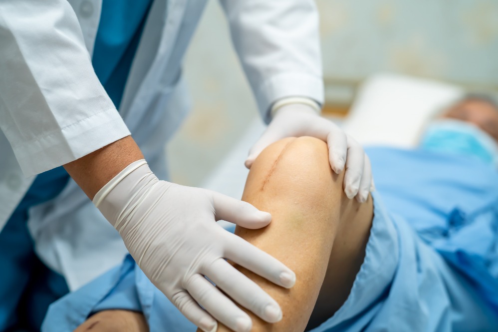 Joint Replacement in Chennai and When It May Be Considered for Persistent Joint Pain main image
