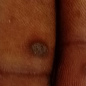Vibha skin