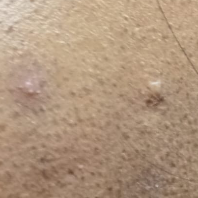 Vibha skin