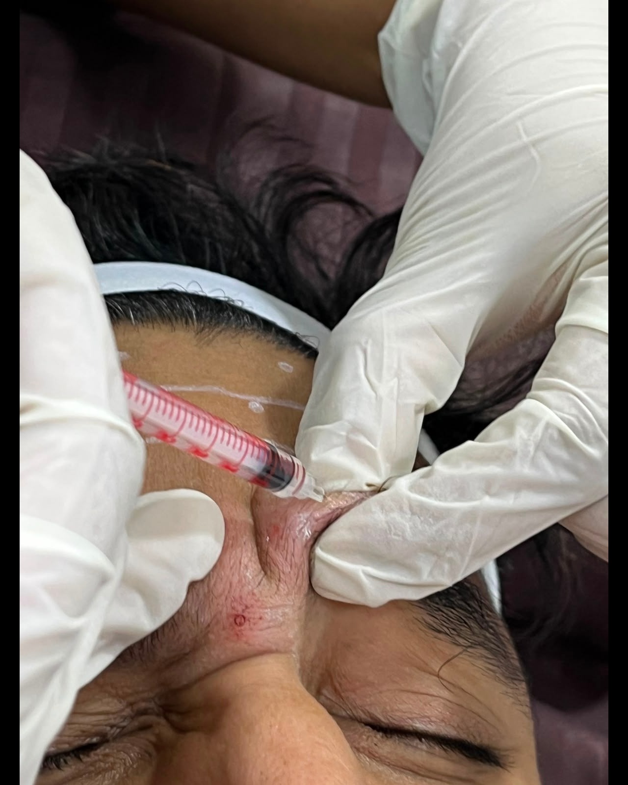 Skin specialist Srirangam main image