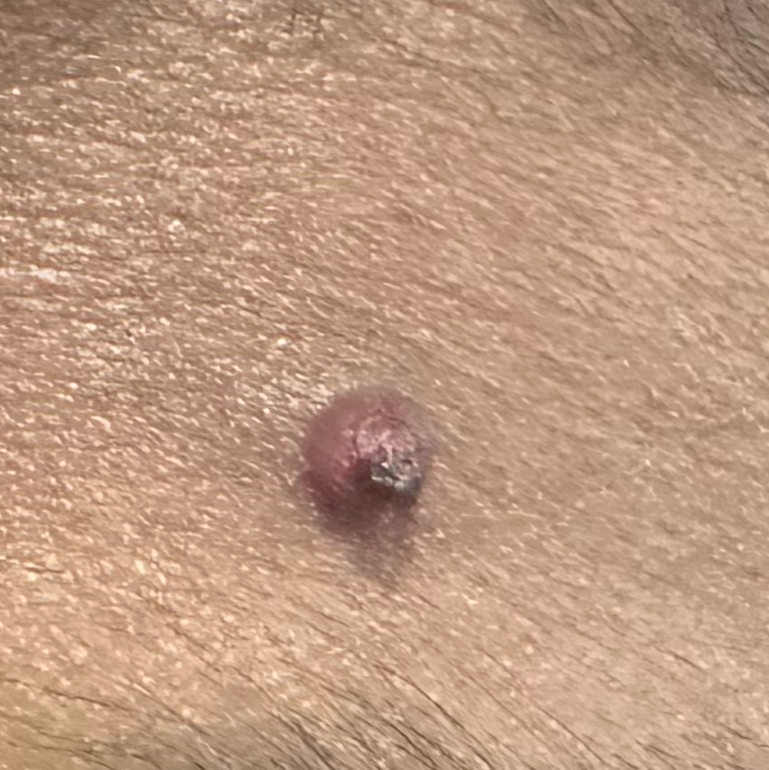 Vibha skin