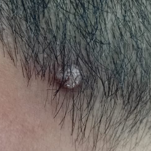 Vibha skin