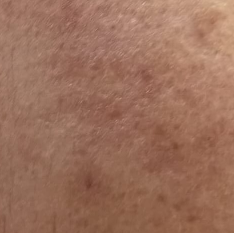 Vibha skin