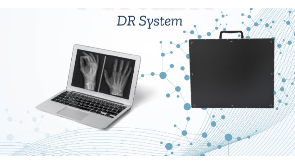 Is a Refurbished DR System Worth Buying? A Practical Guide for Hospitals and Diagnostic Centres in N