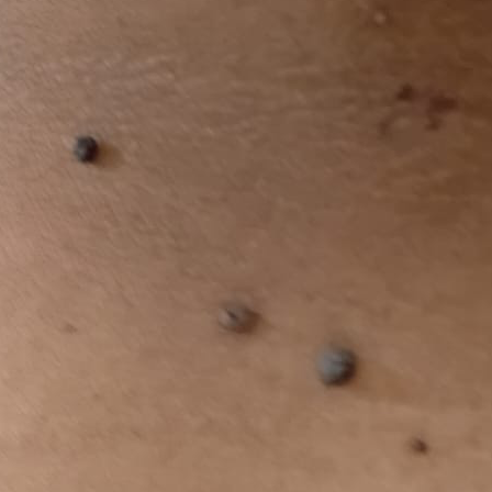 Vibha skin