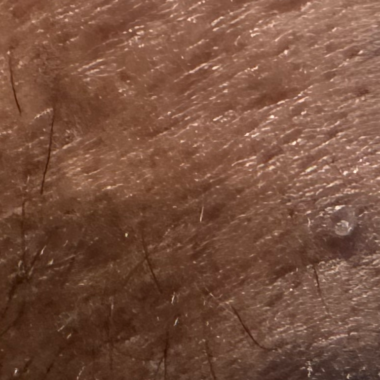 Vibha skin