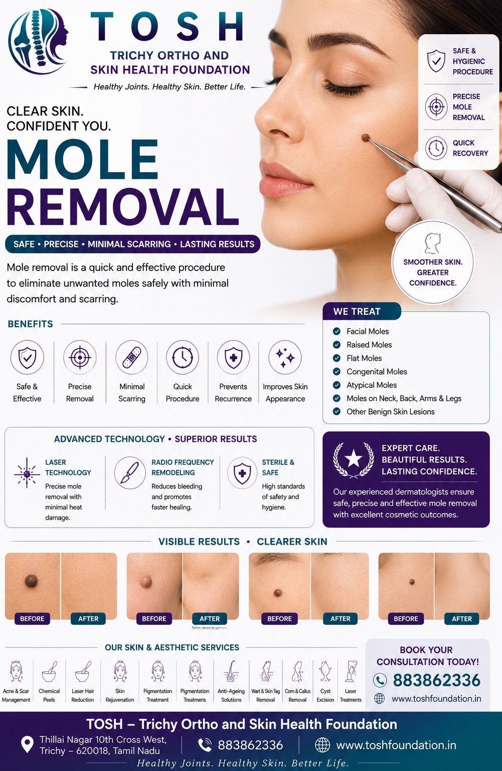 Acne treatment Tennur main image