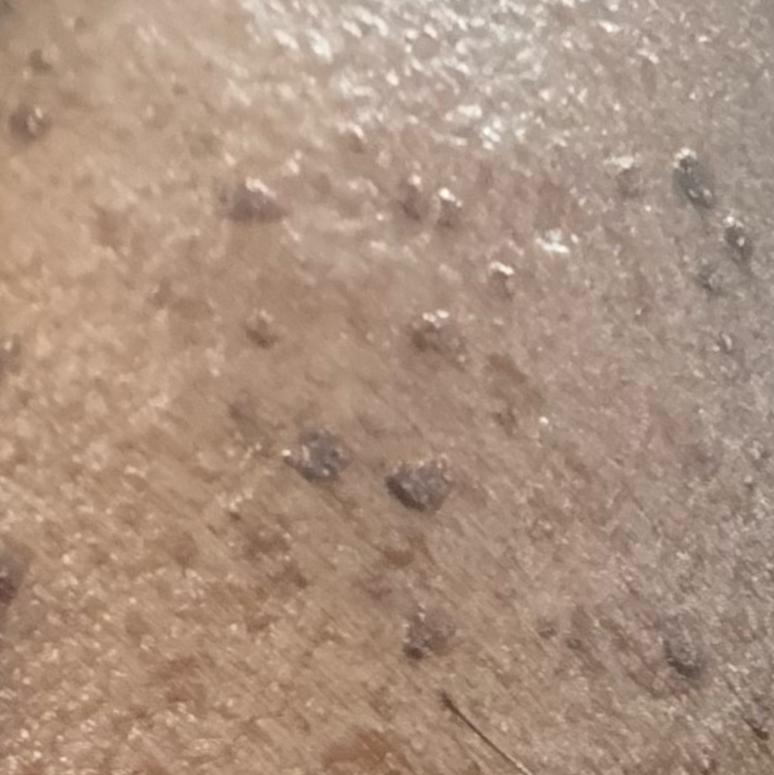 Vibha skin