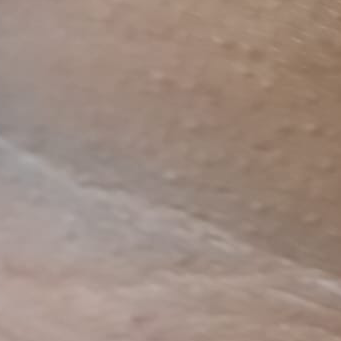 Vibha skin