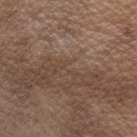 Vibha skin