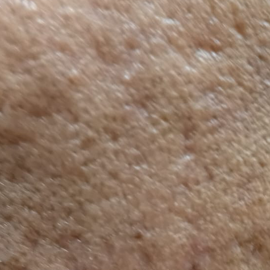 Vibha skin