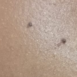 Vibha skin