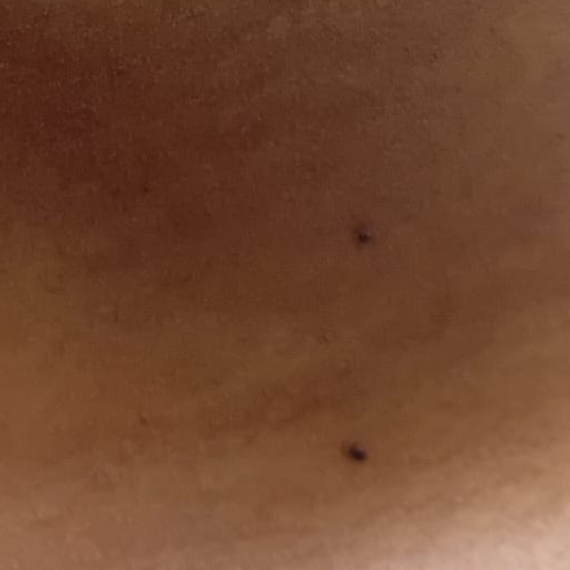 Vibha skin