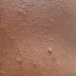 Vibha skin