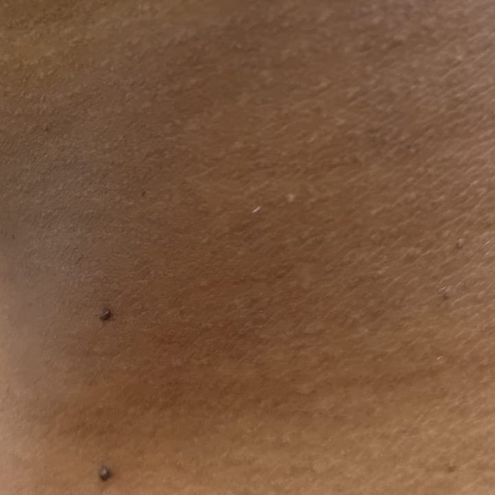 Vibha skin