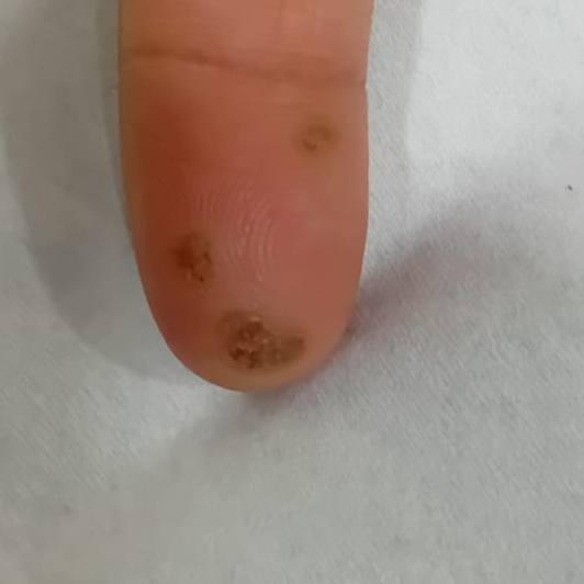 Vibha skin
