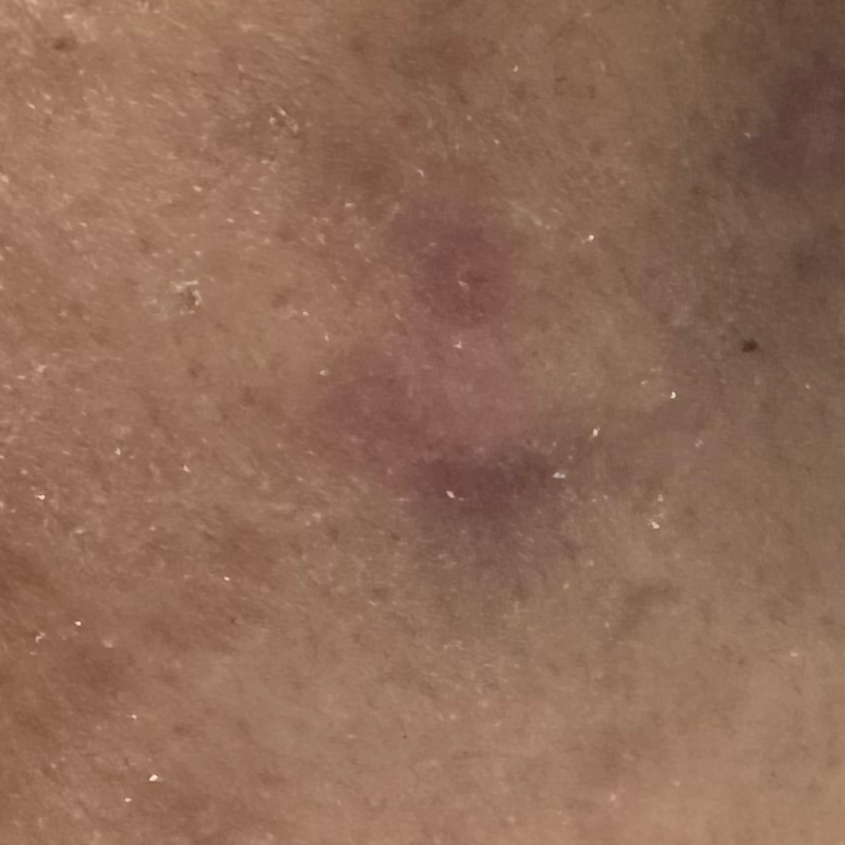 Vibha skin