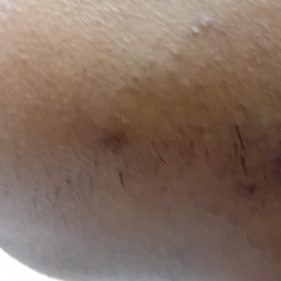 Vibha skin