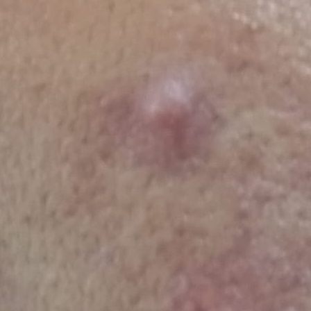 Vibha skin