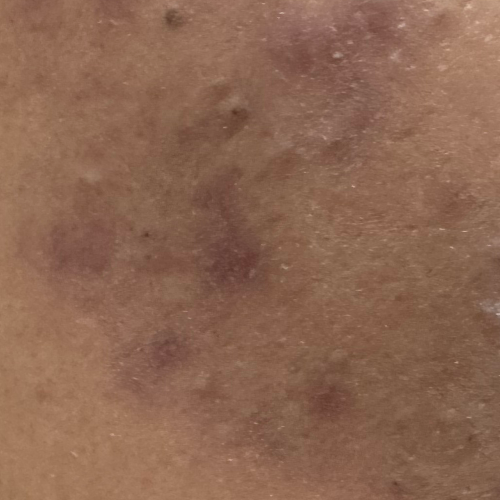 Vibha skin