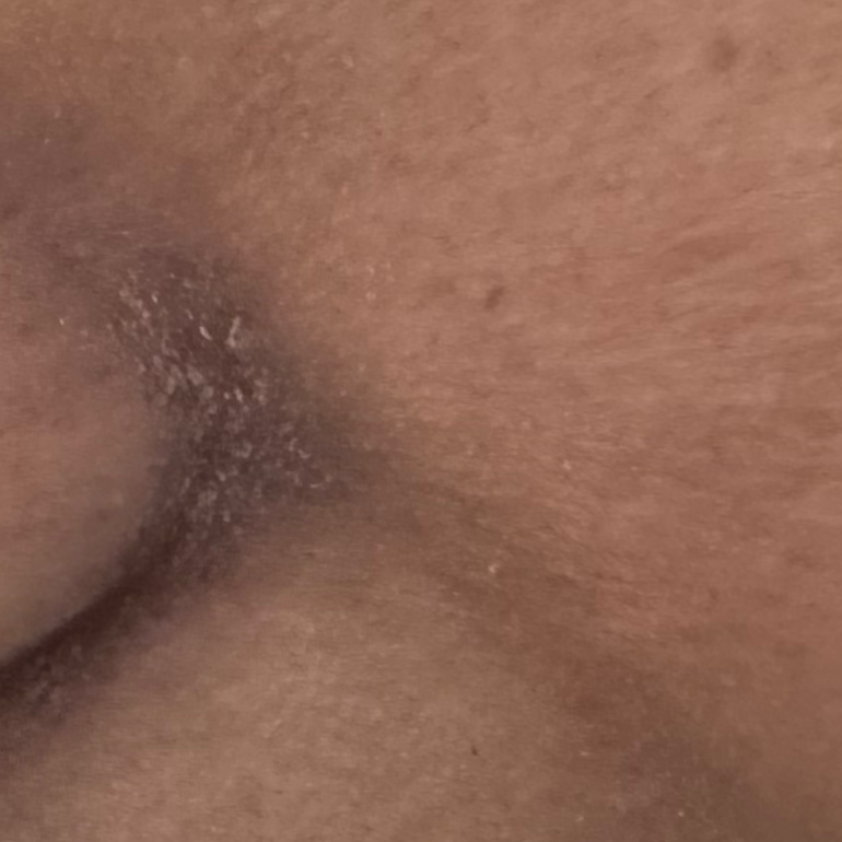 Vibha skin