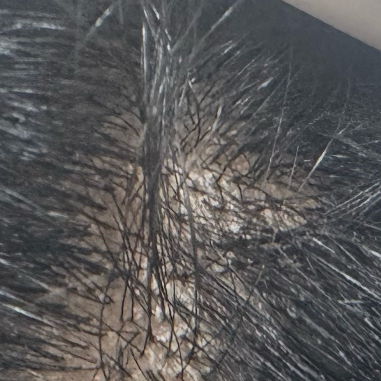 Vibha skin