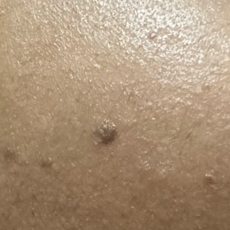 Vibha skin