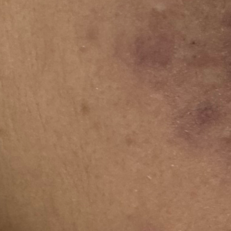 Vibha skin