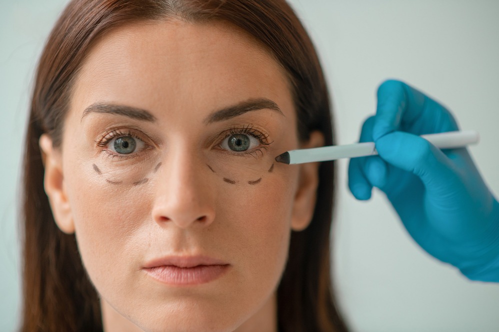 Oculoplasty Services Help Restore Both Eye Function and Facial Appearance