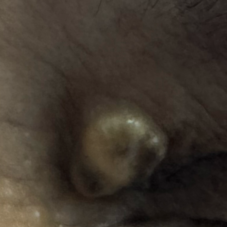 Vibha skin
