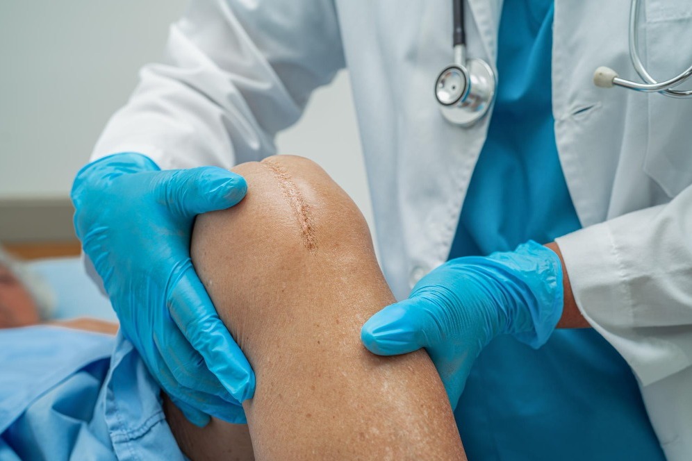 When Is Joint Replacement Considered for Persistent Joint Pain in Thane