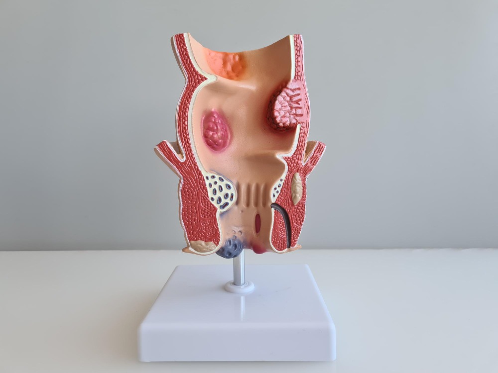 Piles Surgeon in Pune Understanding Treatment Options for Better Recovery
