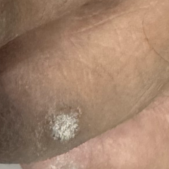Vibha skin