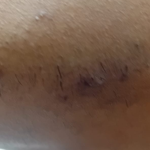 Vibha skin