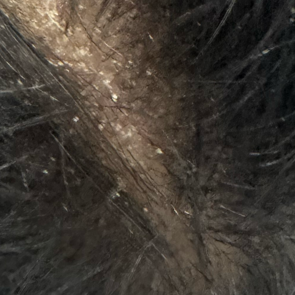 Vibha skin