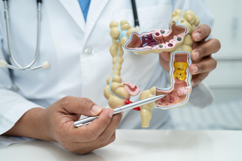 Colon Cancer Surgeon in Pune Shares a Practical Treatment Checklist