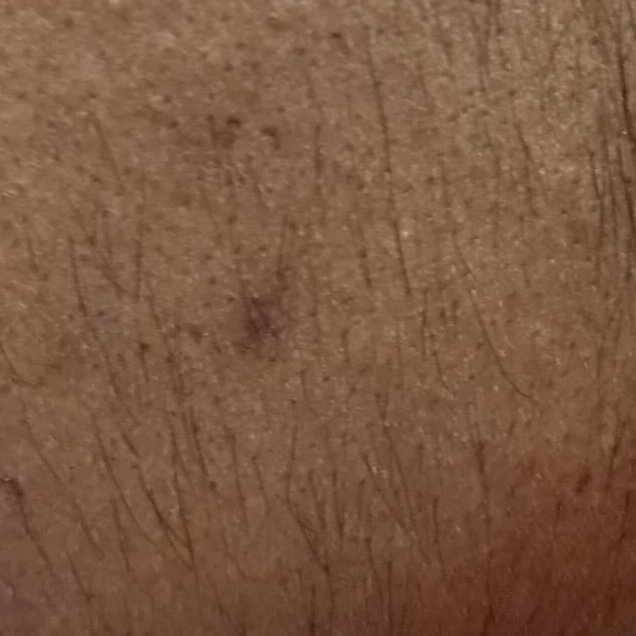 Vibha skin