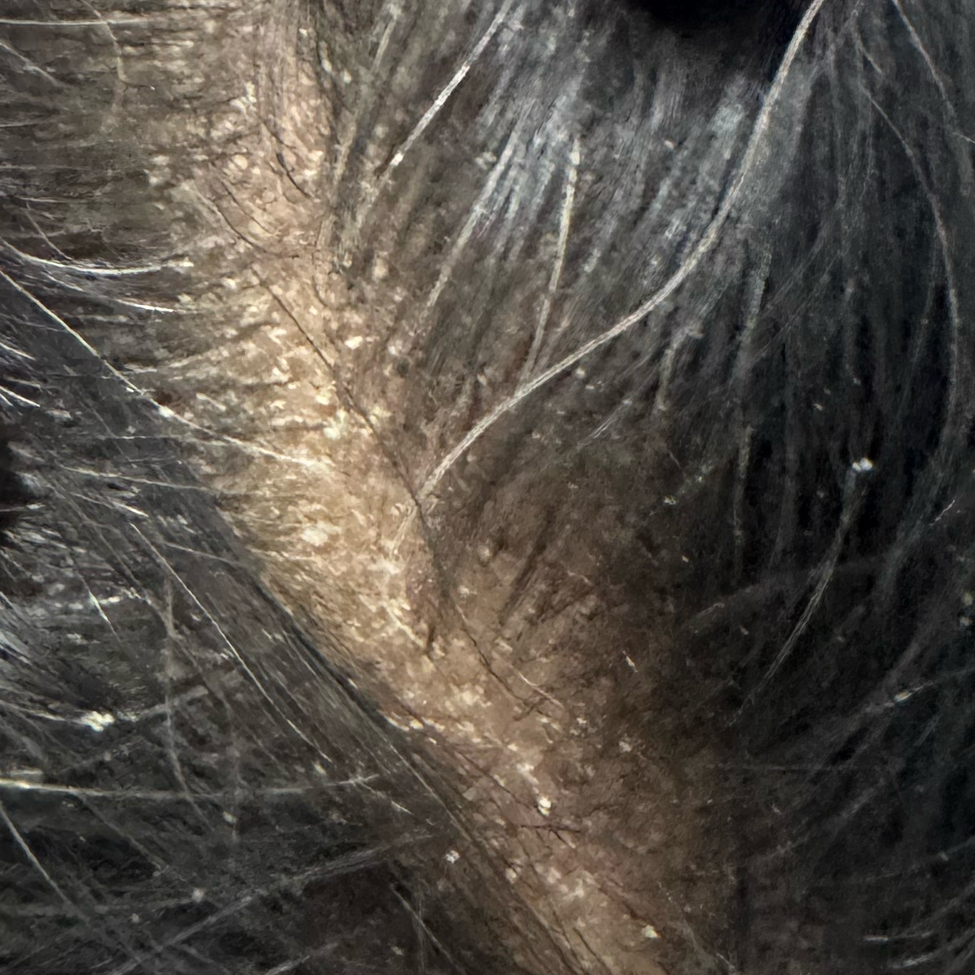 Vibha skin