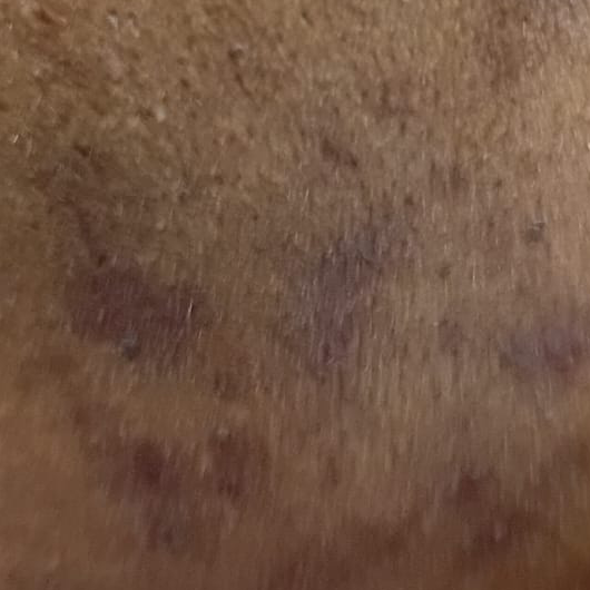 Vibha skin